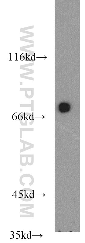 SLP76 Polyclonal antibody