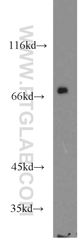 Western Blot (WB) analysis of K-562 cells using SLP76 Polyclonal antibody (12728-1-AP)