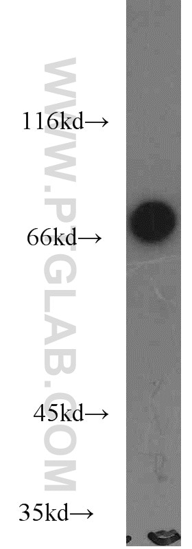 Western Blot (WB) analysis of RAW264.7 using SLP76 Polyclonal antibody (12728-1-AP)