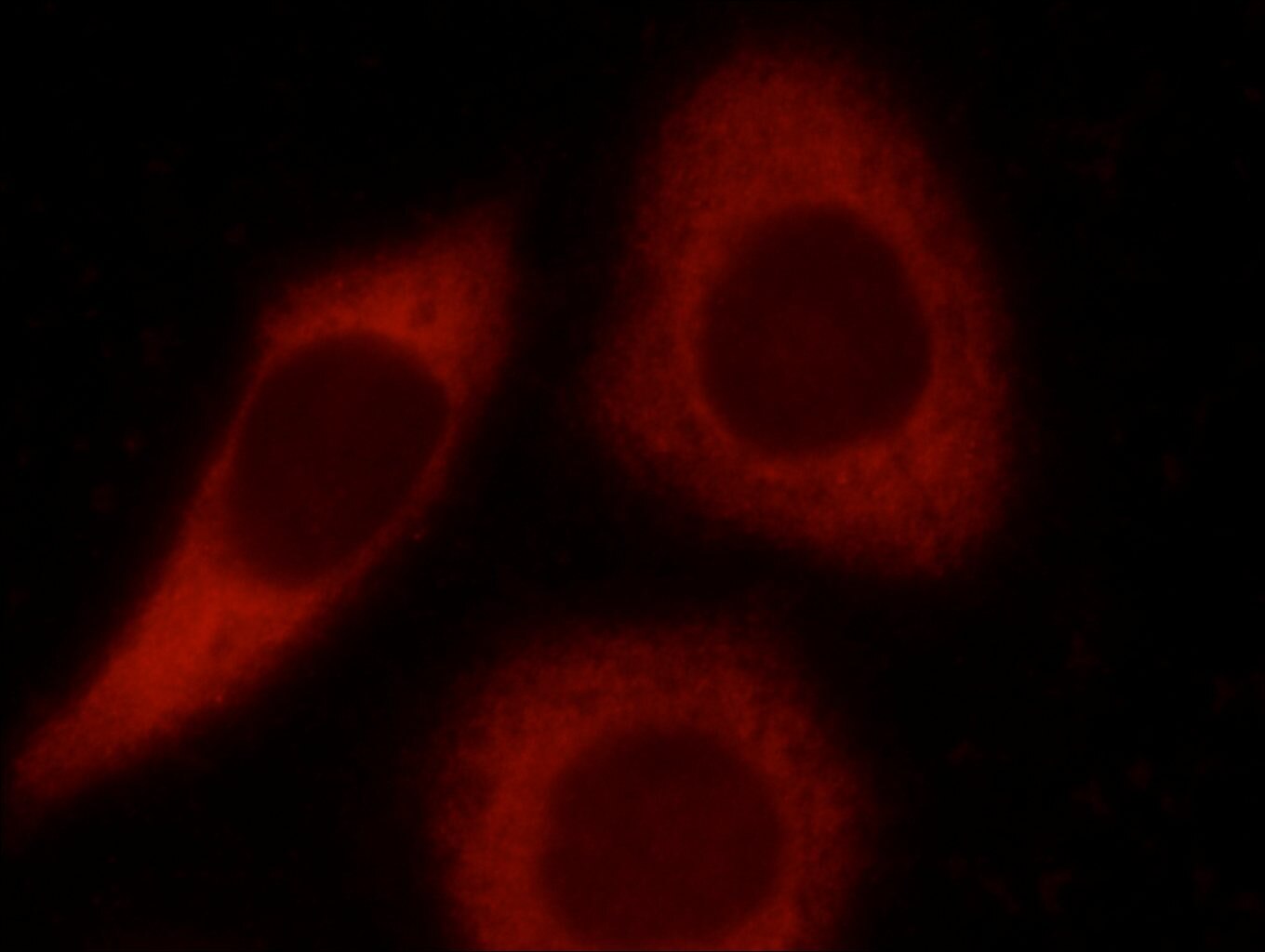 Immunofluorescence (IF) / fluorescent staining of HeLa cells using LCTL Polyclonal antibody (24589-1-AP)
