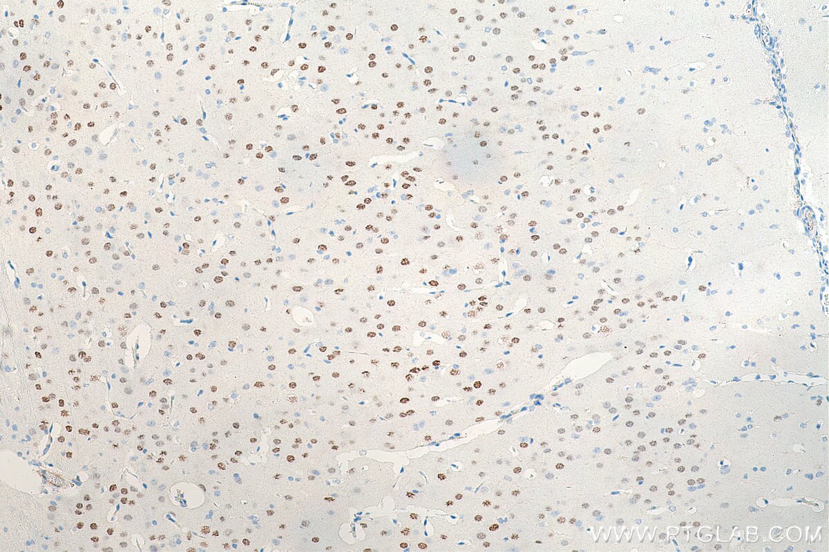 Immunohistochemistry (IHC) staining of rat brain tissue using LDB2 Polyclonal antibody (11873-1-AP)