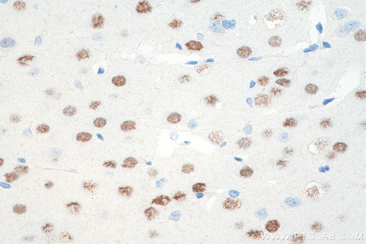 Immunohistochemistry (IHC) staining of rat brain tissue using LDB2 Polyclonal antibody (11873-1-AP)