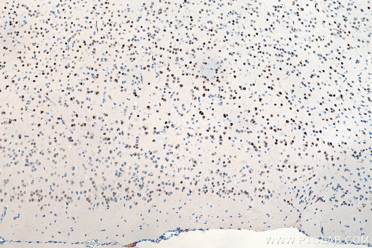 Immunohistochemistry (IHC) staining of mouse brain tissue using LDB2 Polyclonal antibody (11873-1-AP)