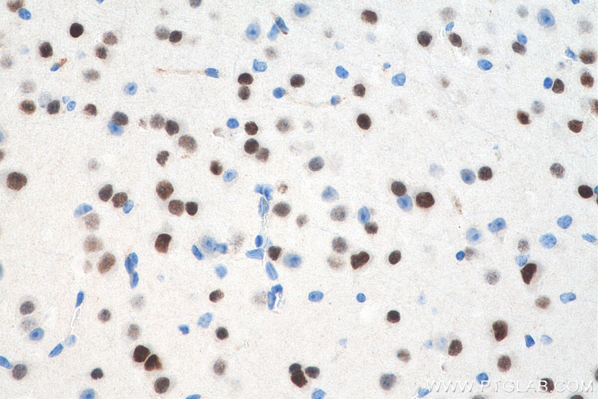 IHC staining of mouse brain using 11873-1-AP