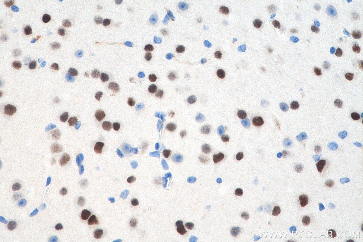 Immunohistochemistry (IHC) staining of mouse brain tissue using LDB2 Polyclonal antibody (11873-1-AP)