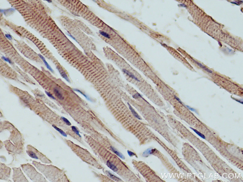 IHC staining of mouse heart using 11004-1-AP