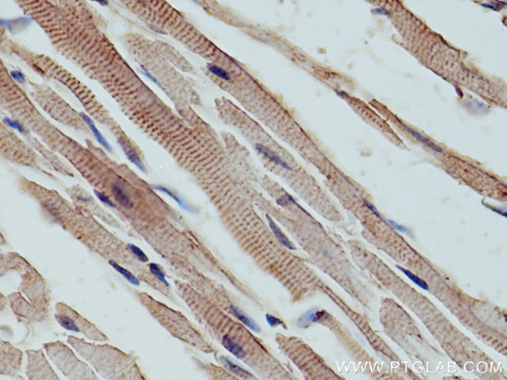 Immunohistochemistry (IHC) staining of mouse heart tissue using LDB3 Polyclonal antibody (11004-1-AP)