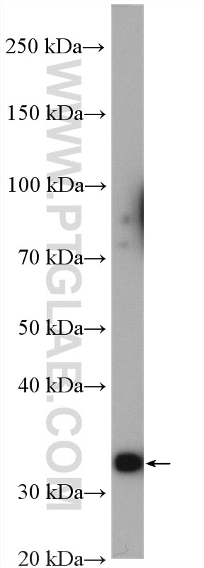 WB analysis of rat heart using 11004-1-AP