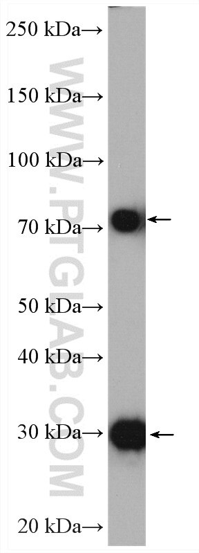 Western Blot (WB) analysis of mouse skeletal muscle tissue using LDB3 Polyclonal antibody (11004-1-AP)