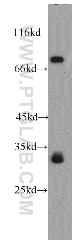 Western Blot (WB) analysis of human skeletal muscle tissue using LDB3 Polyclonal antibody (11004-1-AP)