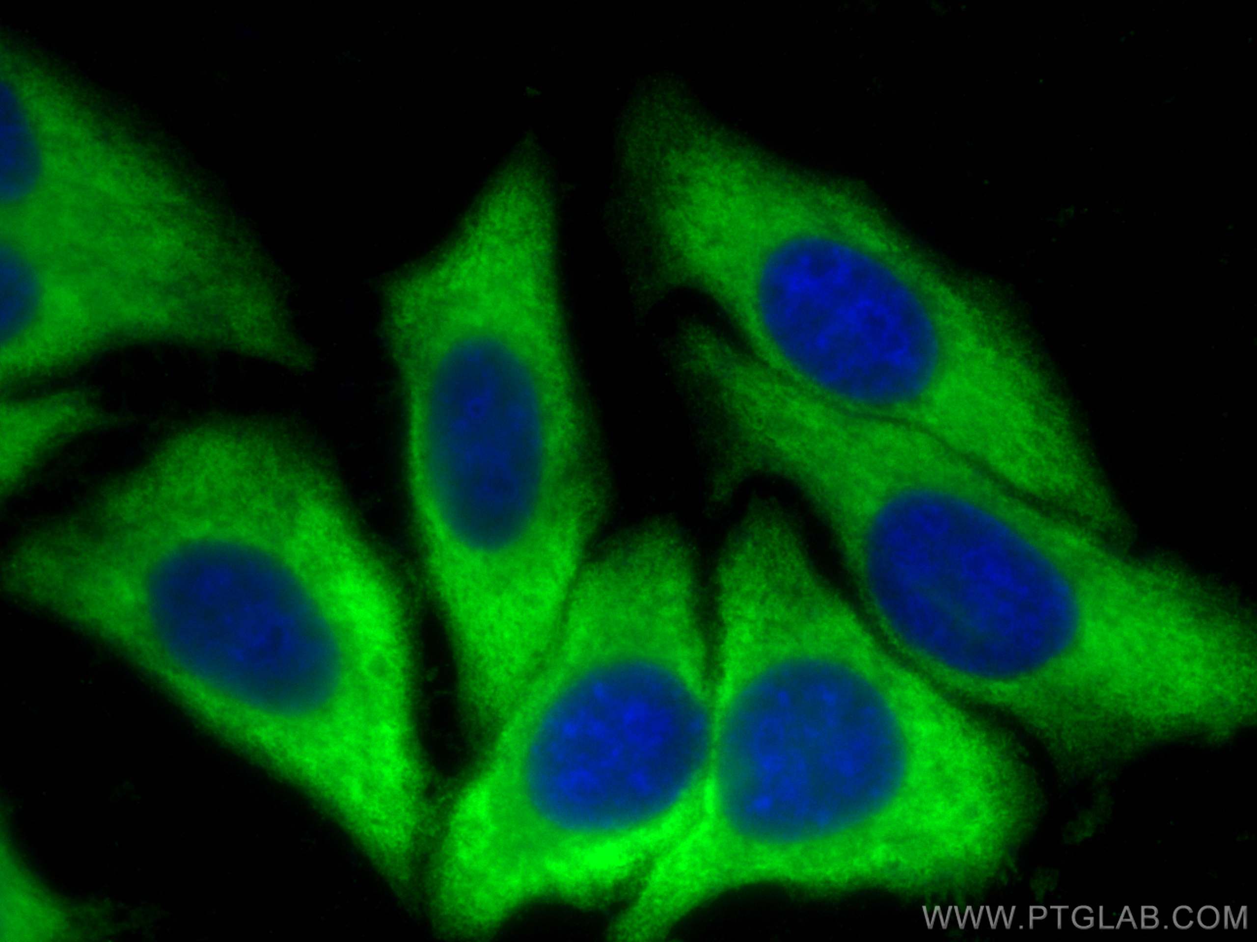 IF Staining of HepG2 using 21799-1-AP