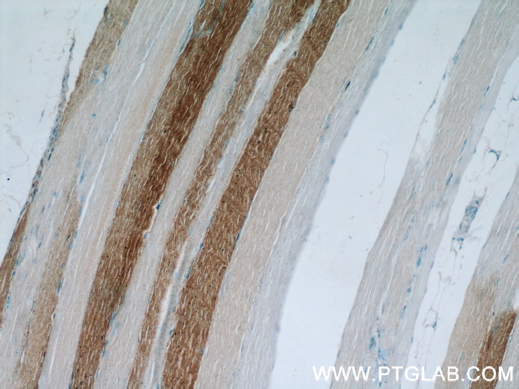 Immunohistochemistry (IHC) staining of human skeletal muscle tissue using LDHA Polyclonal antibody (21799-1-AP)