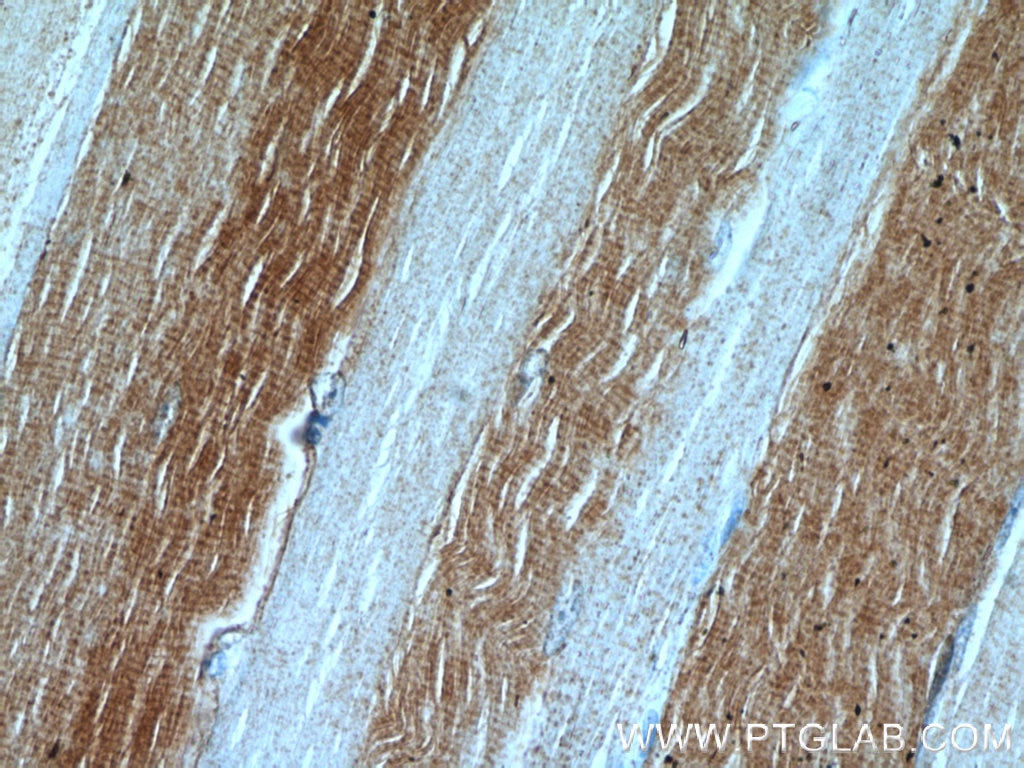 Immunohistochemistry (IHC) staining of human skeletal muscle tissue using LDHA Polyclonal antibody (21799-1-AP)