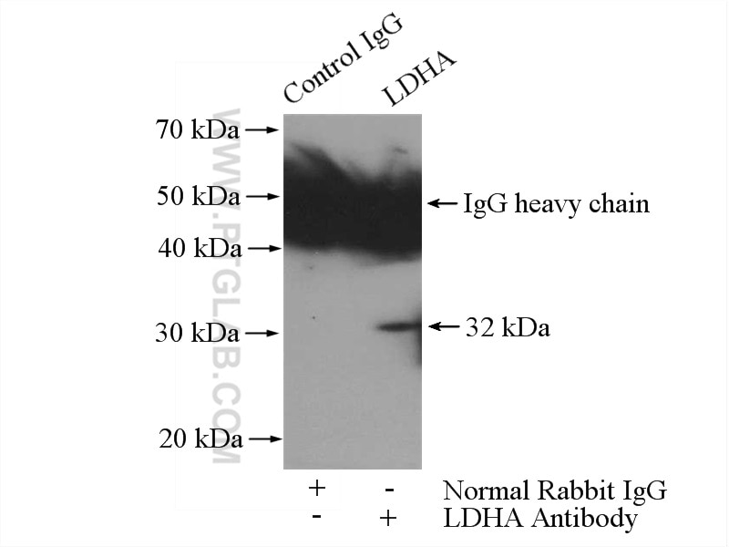 IP experiment of HEK-293 using 21799-1-AP