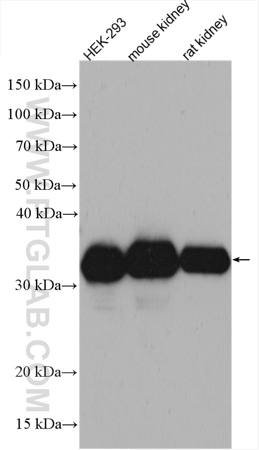 Western Blot (WB) analysis of various lysates using LDHA Polyclonal antibody (21799-1-AP)