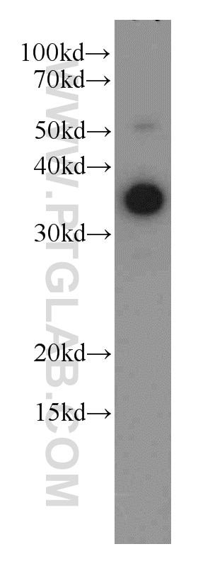 WB analysis of MCF-7 using 21799-1-AP