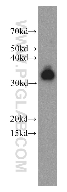 Western Blot (WB) analysis of human testis tissue using LDHA Polyclonal antibody (21799-1-AP)