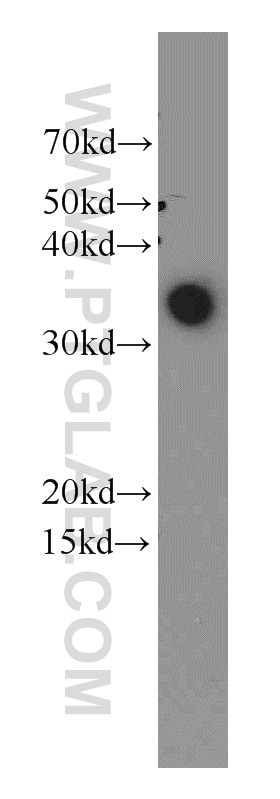 Western Blot (WB) analysis of A375 cells using LDHA Polyclonal antibody (21799-1-AP)