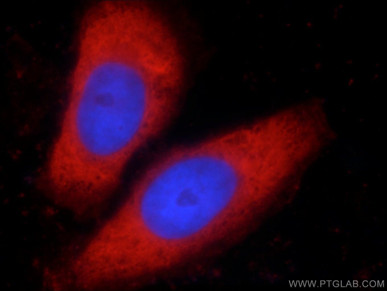 LDHA-Specific Polyclonal antibody