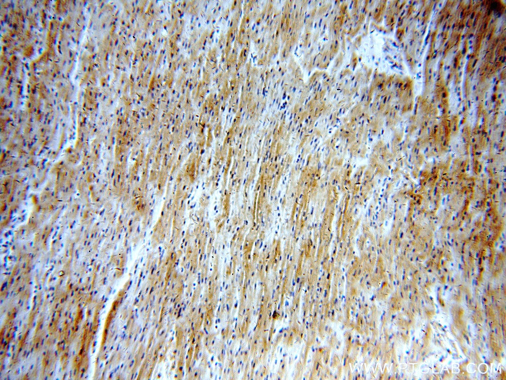 Immunohistochemistry (IHC) staining of human heart tissue using LDHA-Specific Polyclonal antibody (19987-1-AP)