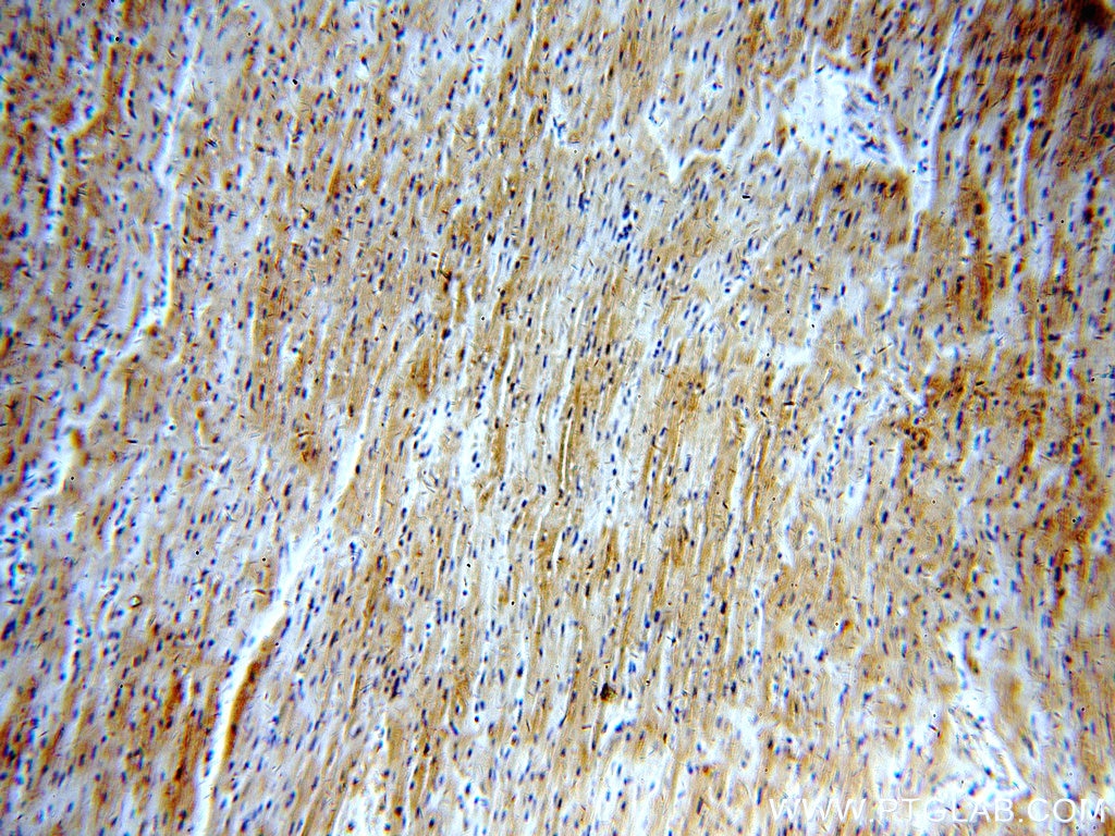 LDHA-Specific Polyclonal antibody