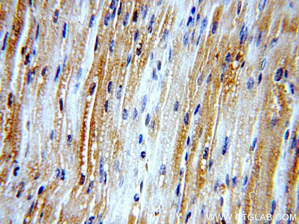 Immunohistochemistry (IHC) staining of human heart tissue using LDHA-Specific Polyclonal antibody (19987-1-AP)