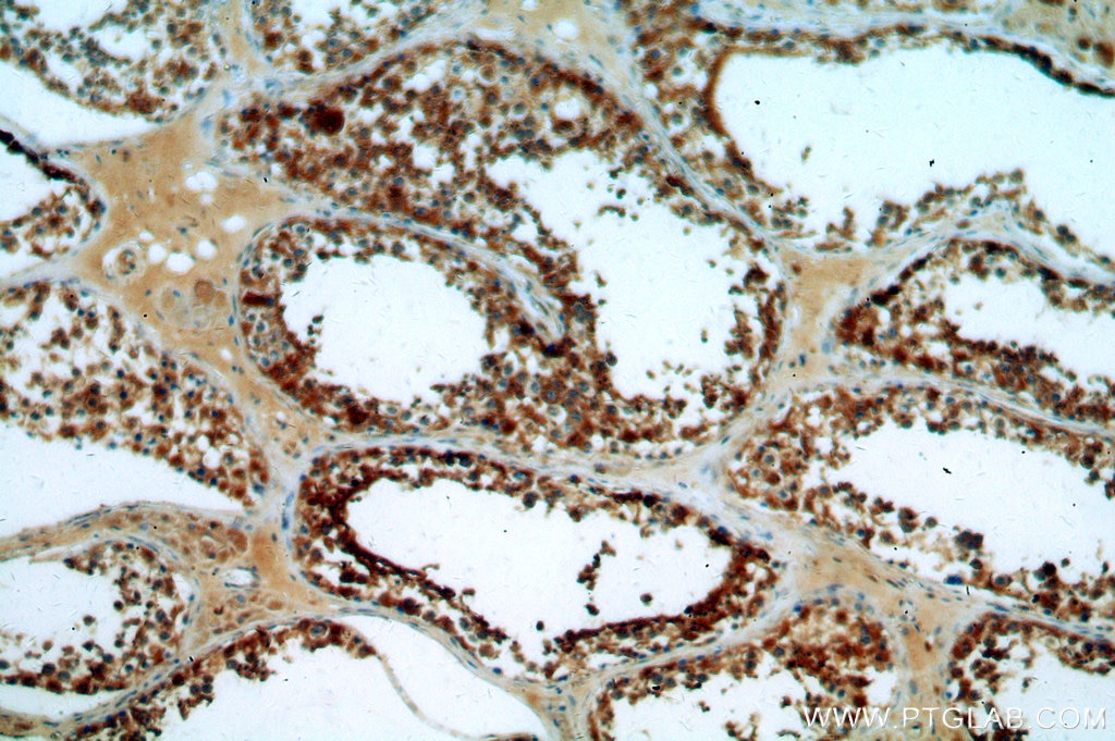 Immunohistochemistry (IHC) staining of human testis tissue using LDHA-Specific Polyclonal antibody (19987-1-AP)