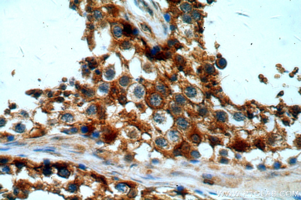 IHC staining of human testis using 19987-1-AP