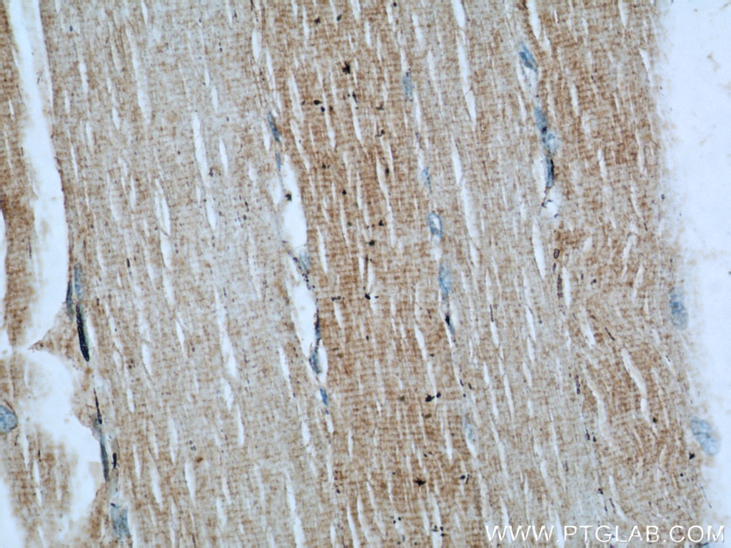 Immunohistochemistry (IHC) staining of human skeletal muscle tissue using LDHA-Specific Polyclonal antibody (19987-1-AP)