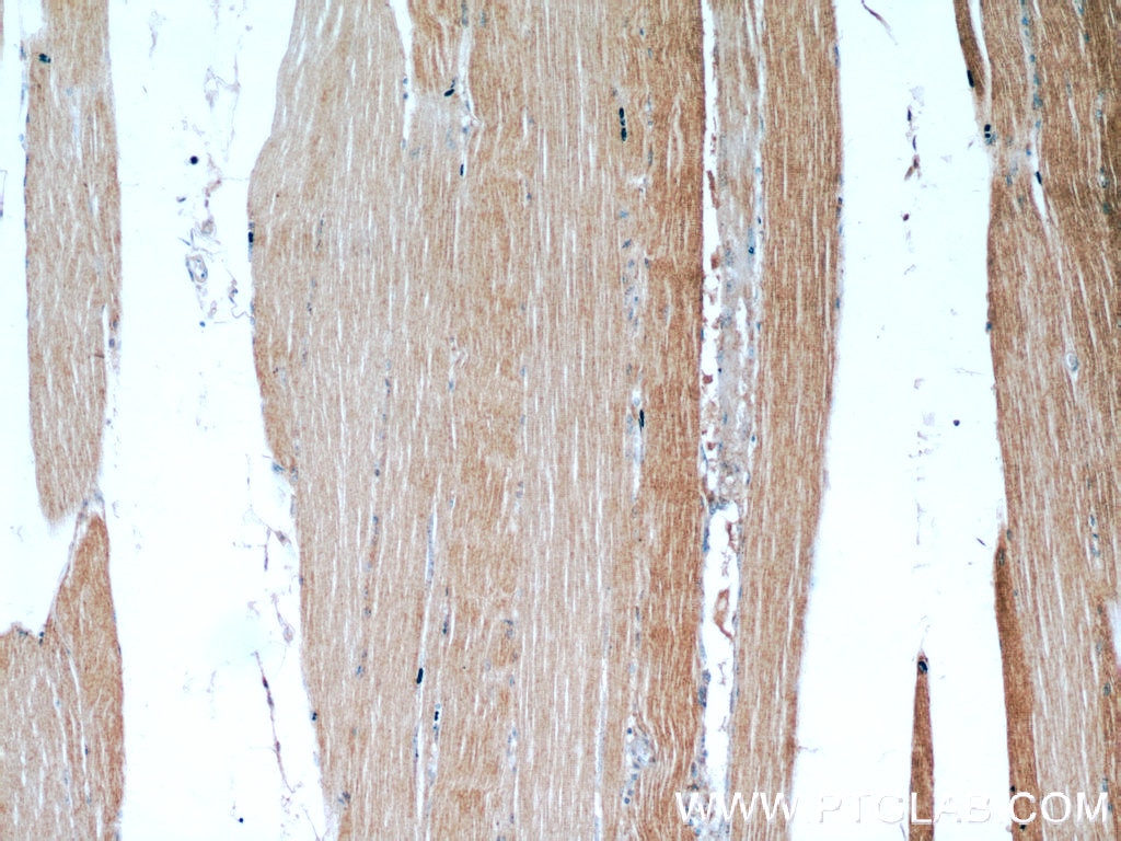 Immunohistochemistry (IHC) staining of human skeletal muscle tissue using LDHA-Specific Polyclonal antibody (19987-1-AP)