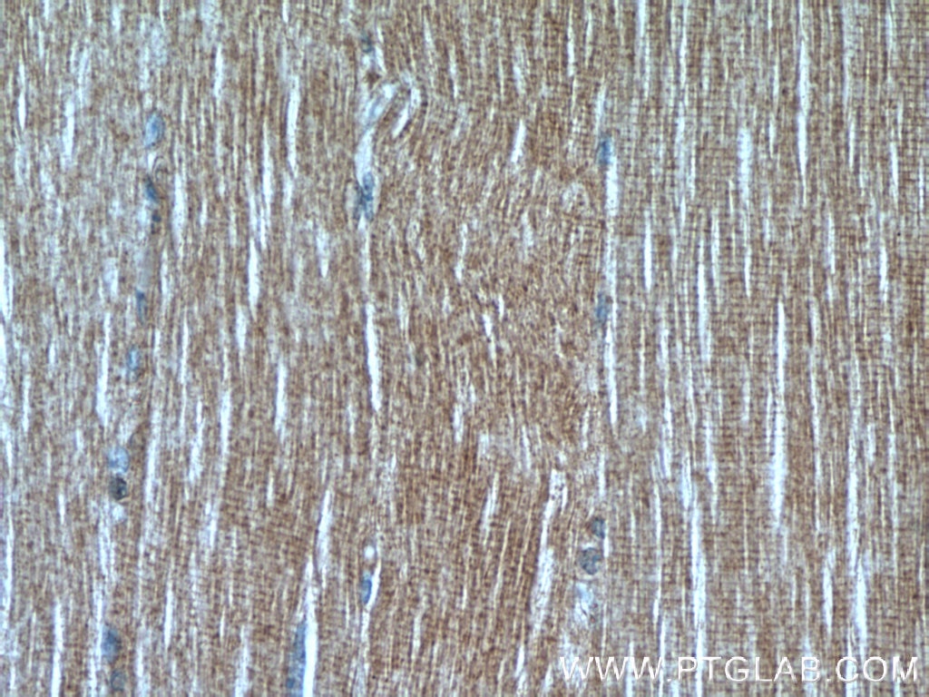 Immunohistochemistry (IHC) staining of human skeletal muscle tissue using LDHA-Specific Polyclonal antibody (19987-1-AP)