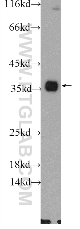 WB analysis of mouse testis using 19987-1-AP