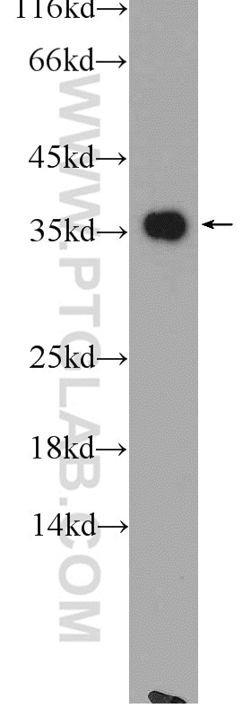 Western Blot (WB) analysis of rat kidney tissue using LDHA-Specific Polyclonal antibody (19987-1-AP)