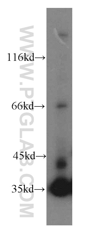 Western Blot (WB) analysis of Jurkat cells using LDHA-Specific Polyclonal antibody (19987-1-AP)