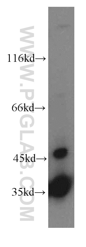 Western Blot (WB) analysis of Jurkat cells using LDHA-Specific Polyclonal antibody (19987-1-AP)