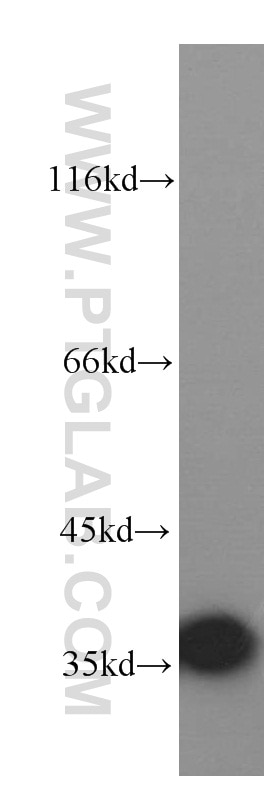 Western Blot (WB) analysis of A431 cells using LDHA-Specific Polyclonal antibody (19987-1-AP)