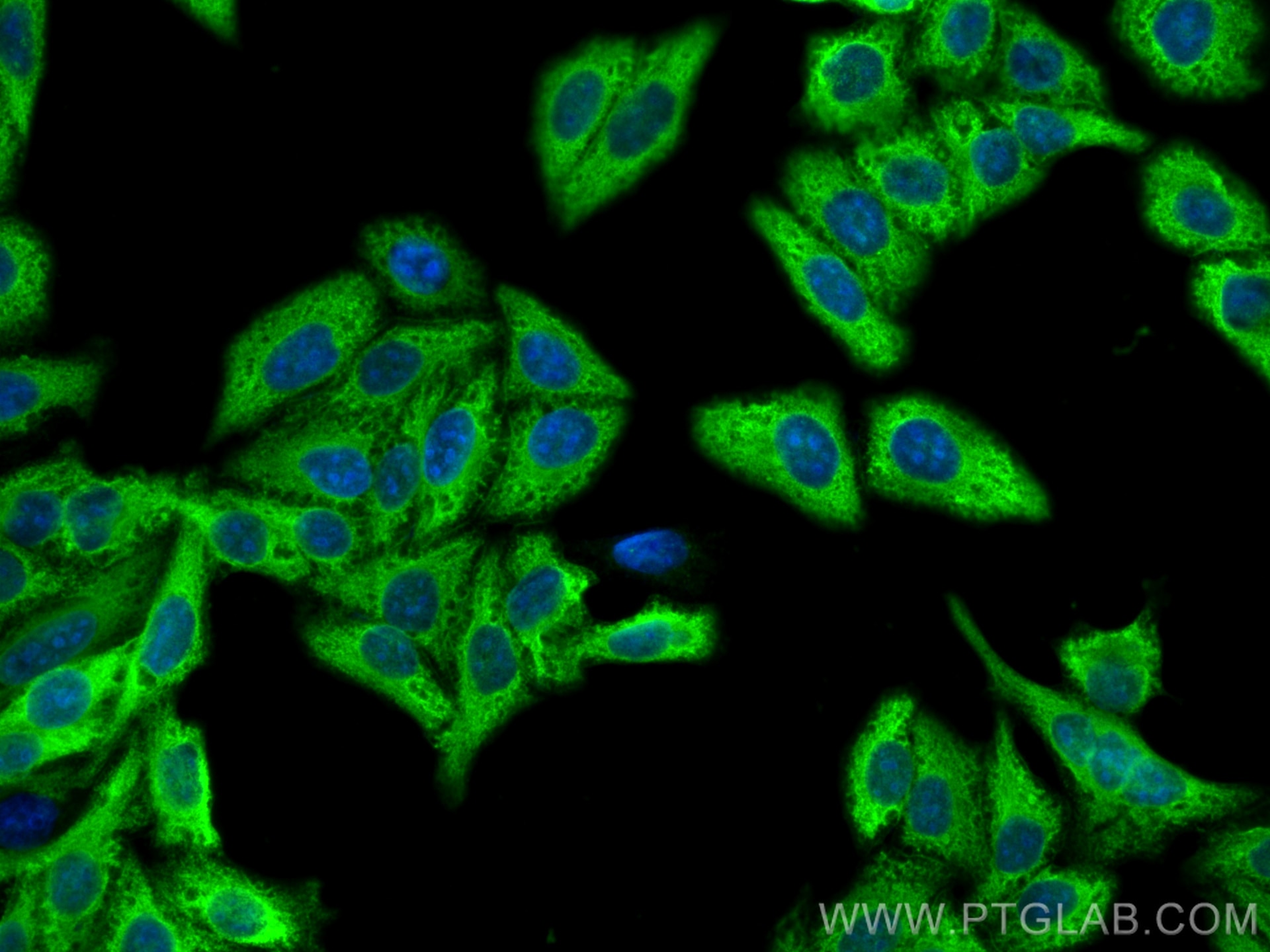 IF Staining of HepG2 using CL488-19987