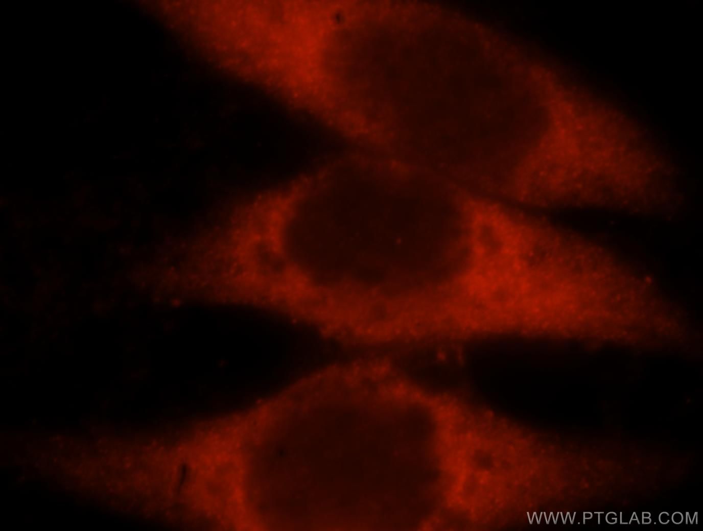 Immunofluorescence (IF) / fluorescent staining of HeLa cells using LDHAL6A Polyclonal antibody (16221-1-AP)