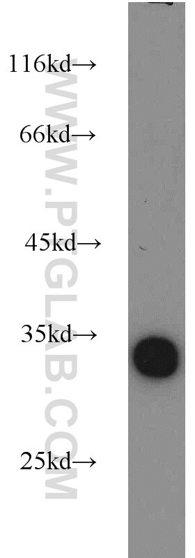 Western Blot (WB) analysis of Jurkat cells using LDHAL6A Polyclonal antibody (16221-1-AP)