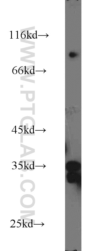 Western Blot (WB) analysis of mouse brain tissue using LDHAL6A Polyclonal antibody (16221-1-AP)