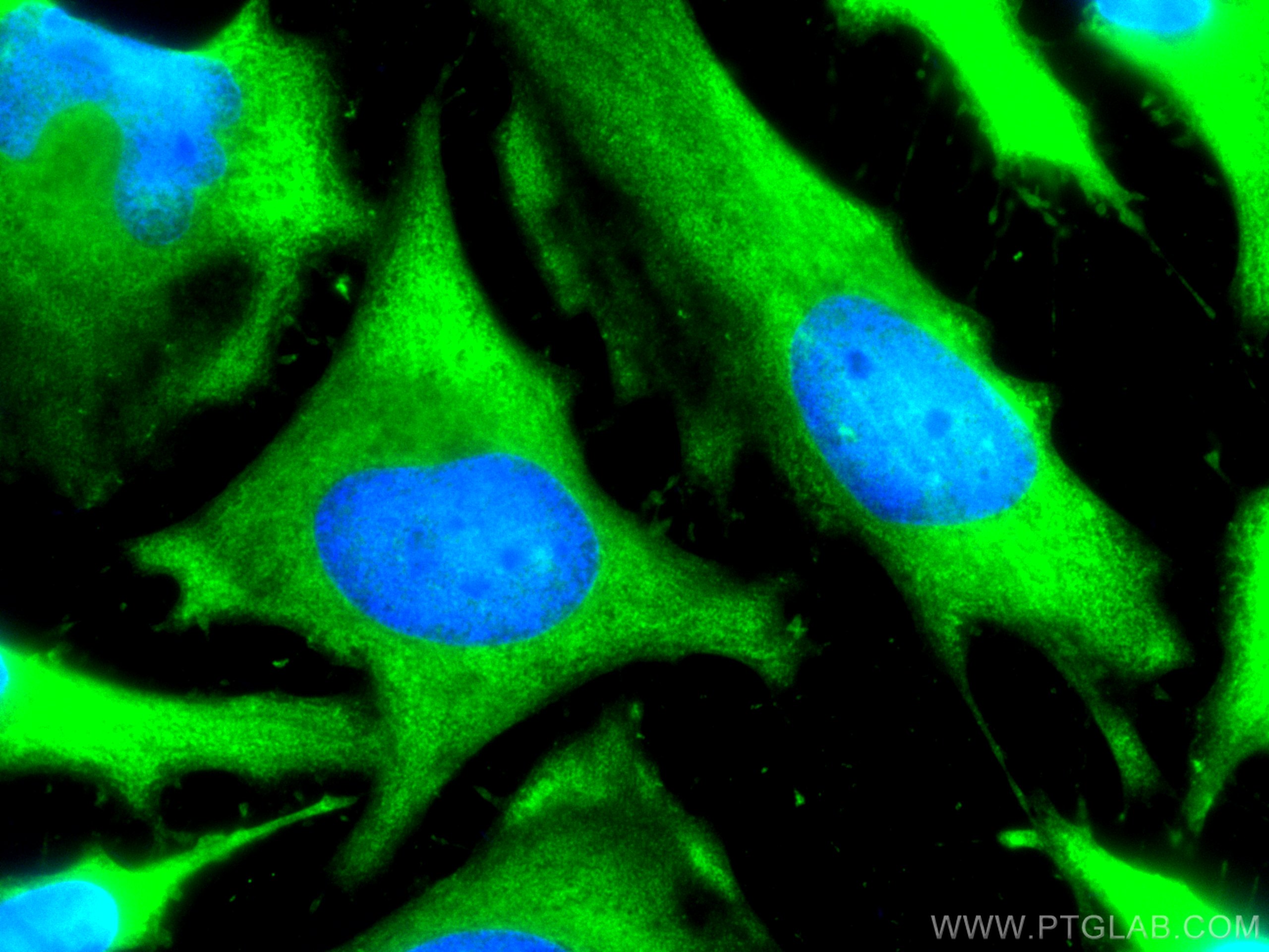 Immunofluorescence (IF) / fluorescent staining of HeLa cells using LDHB Polyclonal antibody (14824-1-AP)
