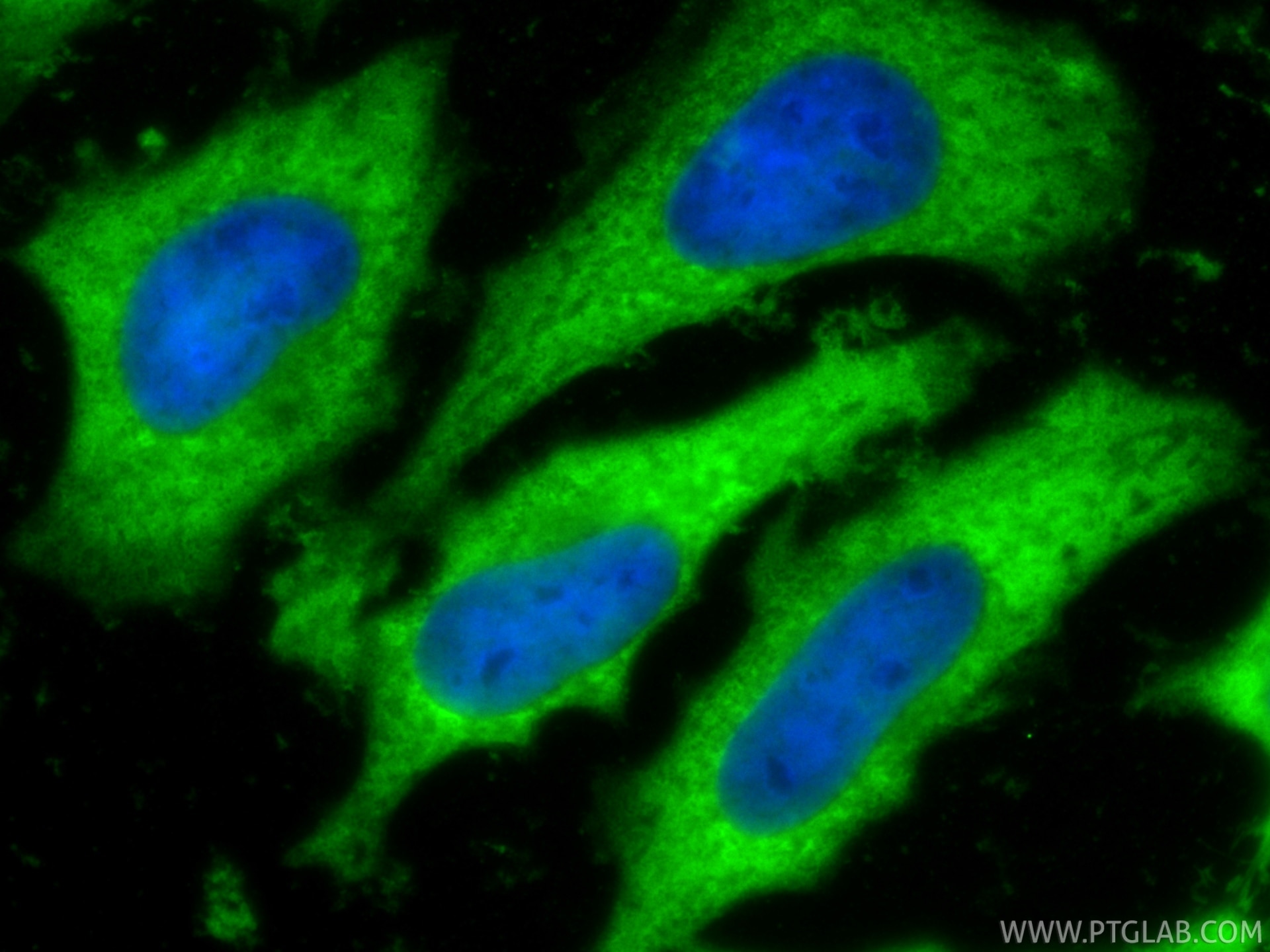 Immunofluorescence (IF) / fluorescent staining of HeLa cells using LDHB Polyclonal antibody (14824-1-AP)