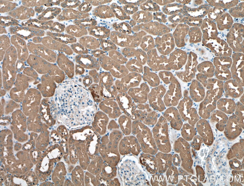 Immunohistochemistry (IHC) staining of human kidney tissue using LDHB Polyclonal antibody (14824-1-AP)