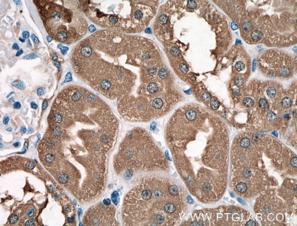 Immunohistochemistry (IHC) staining of human kidney tissue using LDHB Polyclonal antibody (14824-1-AP)