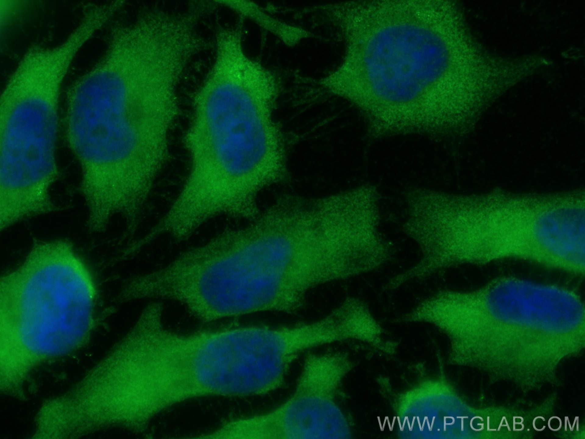 Immunofluorescence (IF) / fluorescent staining of HeLa cells using LDHB-Specific Polyclonal antibody (19988-1-AP)