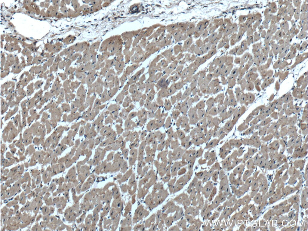 IHC staining of human heart using 19988-1-AP