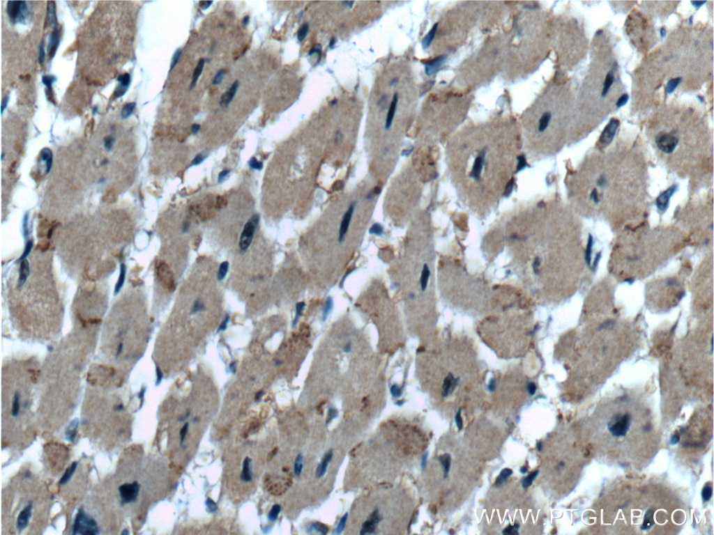 IHC staining of human heart using 19988-1-AP