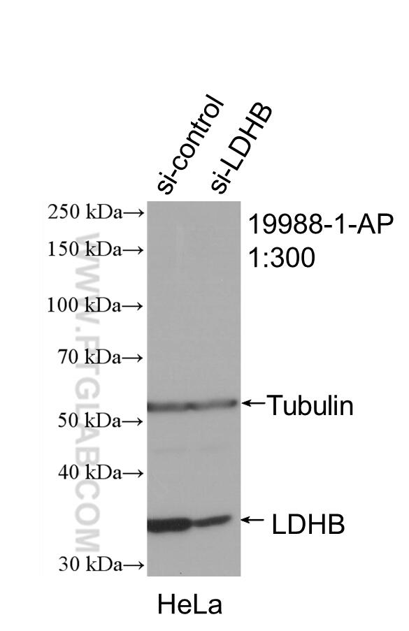 Western Blot (WB) analysis of HeLa cells using LDHB-Specific Polyclonal antibody (19988-1-AP)