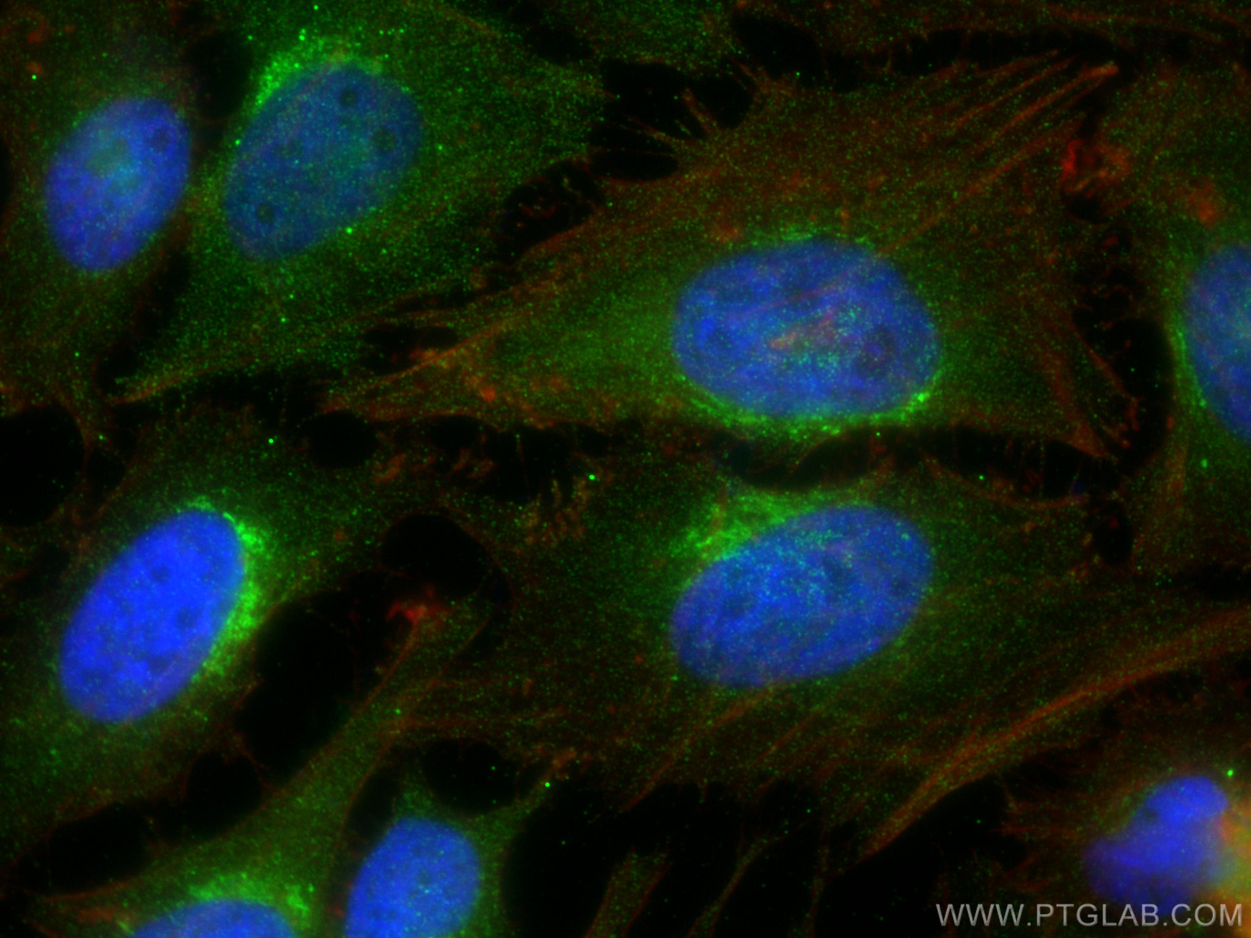 Immunofluorescence (IF) / fluorescent staining of HeLa cells using LDHB Recombinant antibody (81963-1-RR)