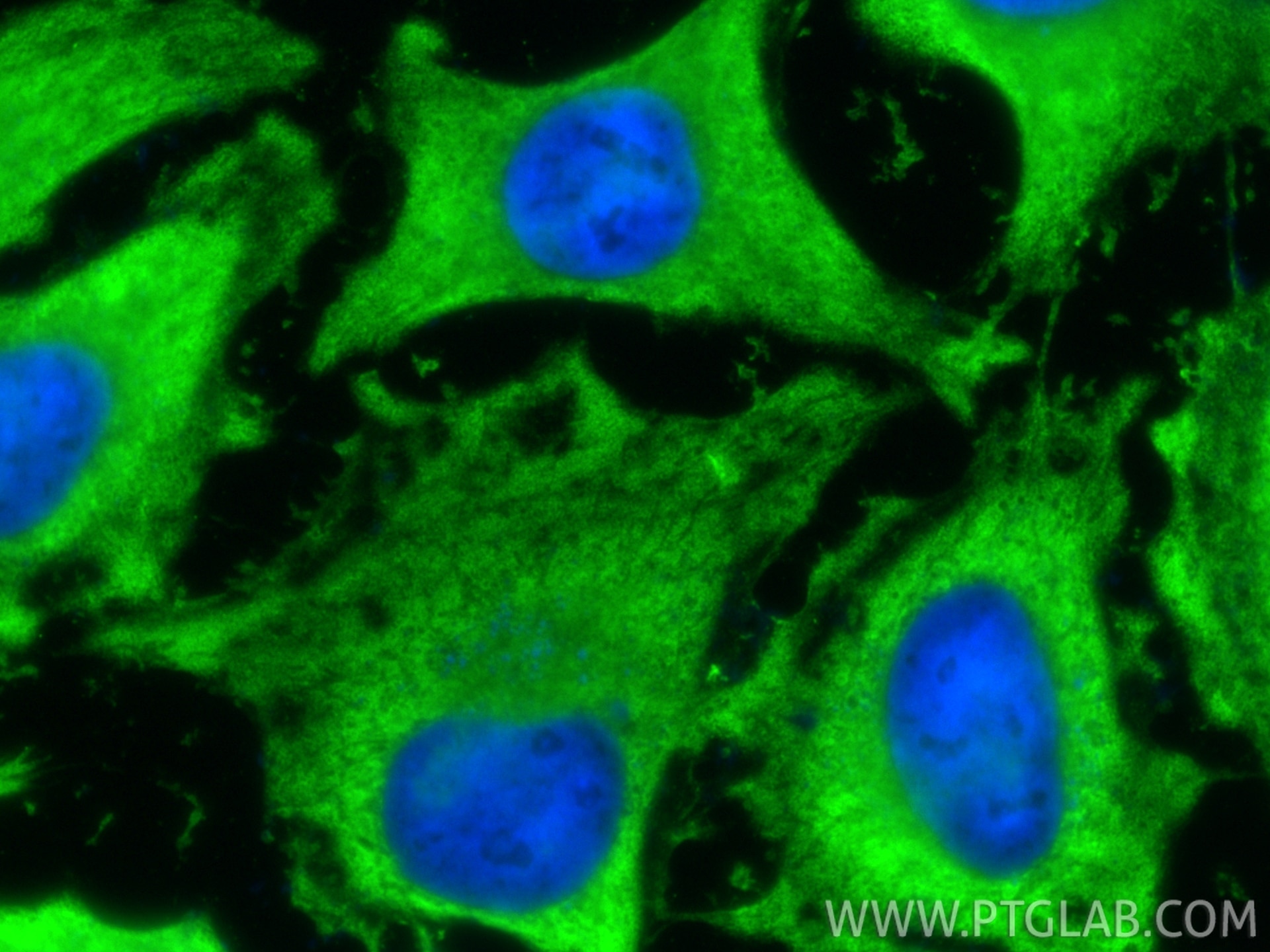 Immunofluorescence (IF) / fluorescent staining of HeLa cells using LDHB Recombinant monoclonal antibody (81963-1-RR)